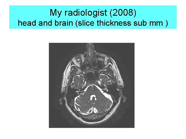 My radiologist (2008) head and brain (slice thickness sub mm ) 