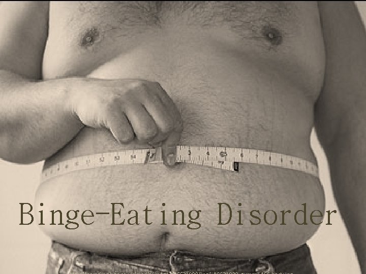 Binge-Eating Disorder 