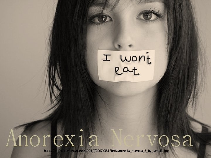 Anorexia Nervosa http: //img 01. deviantart. net/1925/i/2007/331/b/0/anorexia_nervosa_2_by_avitalik. jpg 