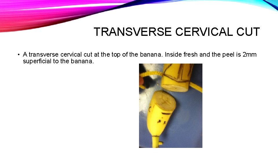 TRANSVERSE CERVICAL CUT • A transverse cervical cut at the top of the banana.