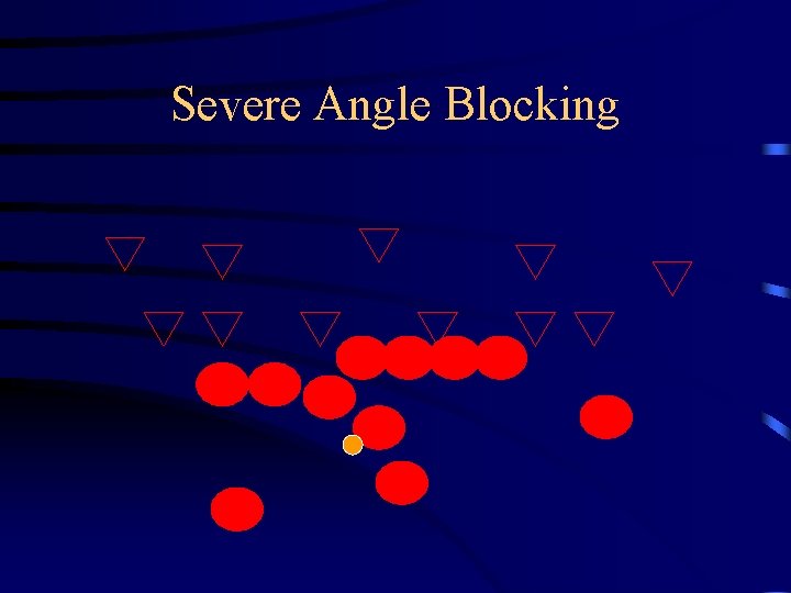 Severe Angle Blocking 
