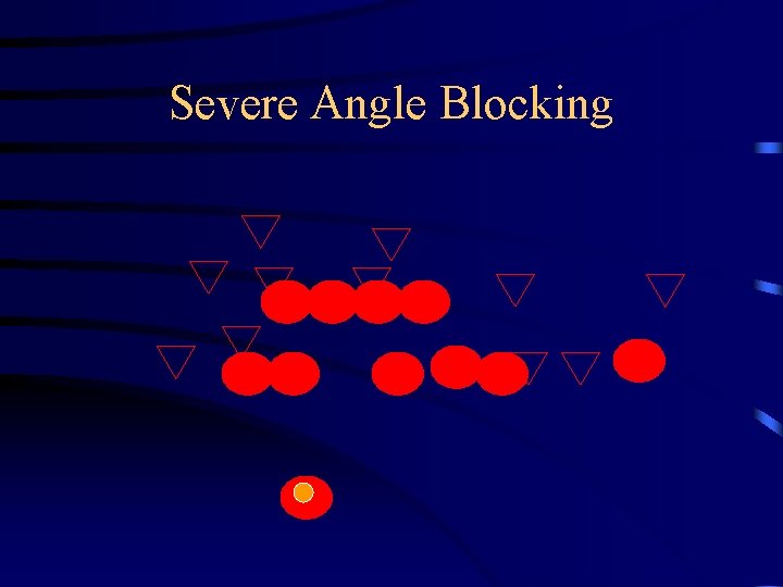 Severe Angle Blocking 