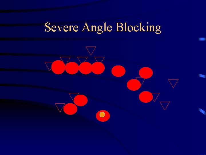 Severe Angle Blocking 