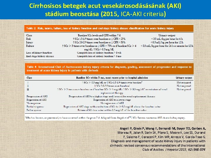 Cirrhosisos betegek acut vesekárosodásásának (AKI) stádium beosztása (2015, ICA-AKI criteria) Angeli P, Ginès P,