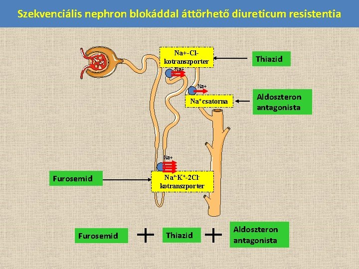 Szekvenciális nephron blokáddal áttörhető diureticum resistentia Na+-Clkotranszporter Thiazid Na+ Na+ csatorna Aldoszteron antagonista Na+