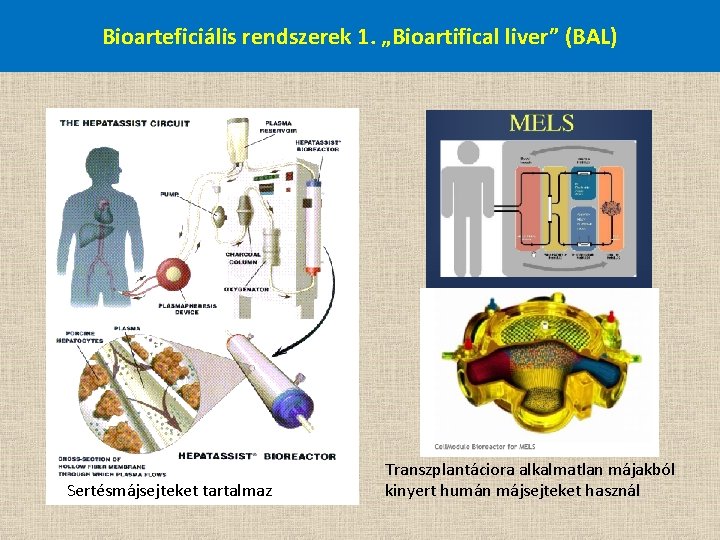 Bioarteficiális rendszerek 1. „Bioartifical liver” (BAL) Sertésmájsejteket tartalmaz Transzplantáciora alkalmatlan májakból kinyert humán májsejteket