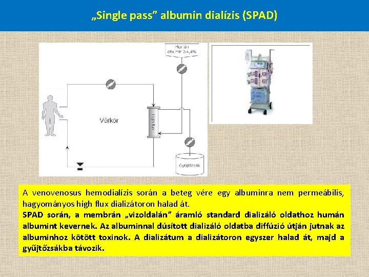 „Single pass” albumin dialízis (SPAD) A venosus hemodialízis során a beteg vére egy albuminra