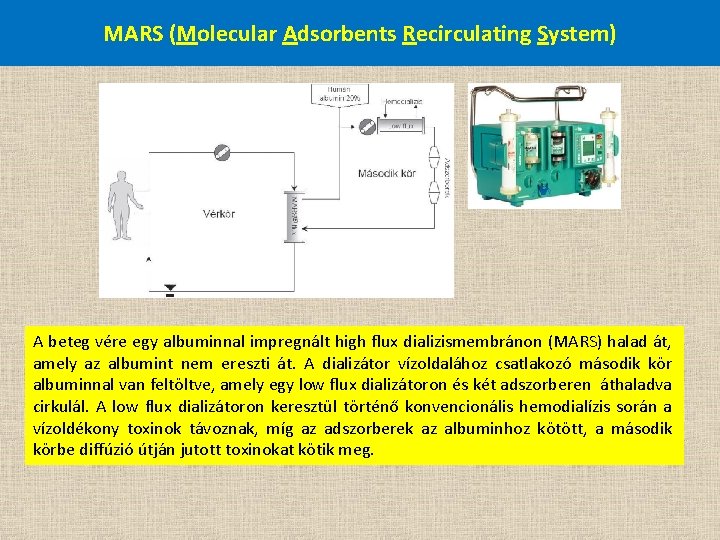 MARS (Molecular Adsorbents Recirculating System) A beteg vére egy albuminnal impregnált high flux dializismembránon