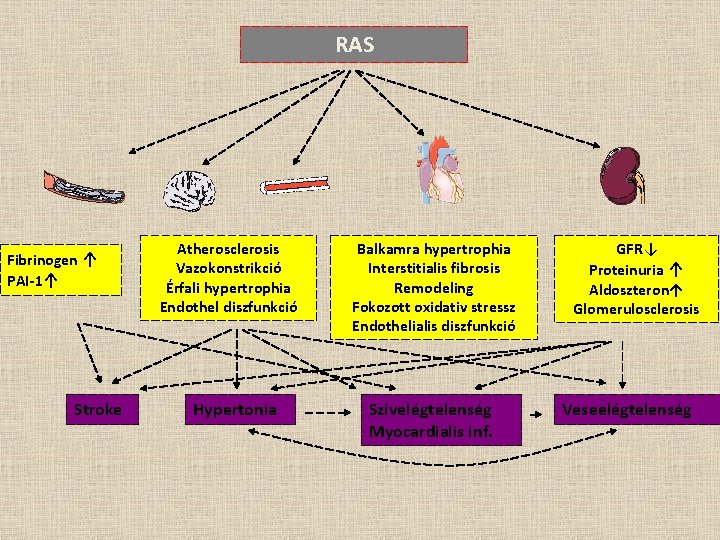 RAS Fibrinogen ↑ PAI-1↑ Stroke Atherosclerosis Vazokonstrikció Érfali hypertrophia Endothel diszfunkció Hypertonia Balkamra hypertrophia