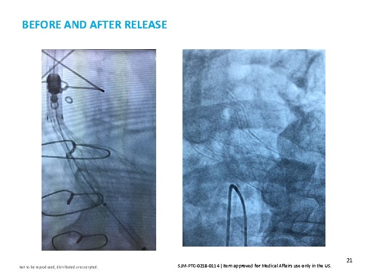 BEFORE AND AFTER RELEASE Not to be reproduced, distributed or excerpted. SJM-PTC-0218 -0114 Item