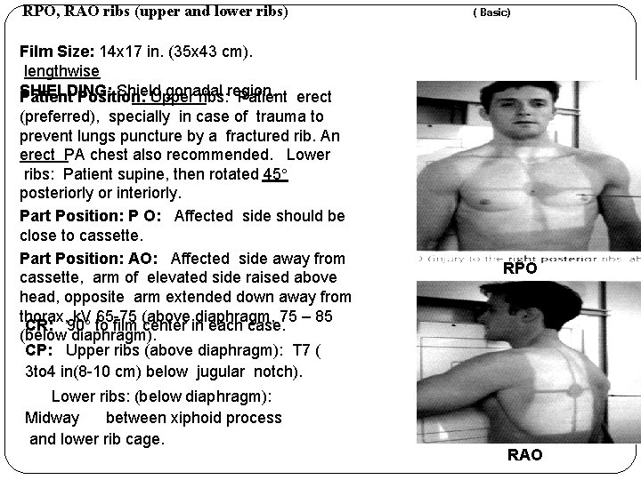 RPO, RAO ribs (upper and lower ribs) Film Size: 14 x 17 in. (35