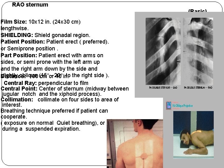 RAO sternum (Basic) Film Size: 10 x 12 in. (24 x 30 cm) lengthwise. RAO sternum (Basic) Film Size: 10 x 12 in. (24 x 30 cm) lengthwise.