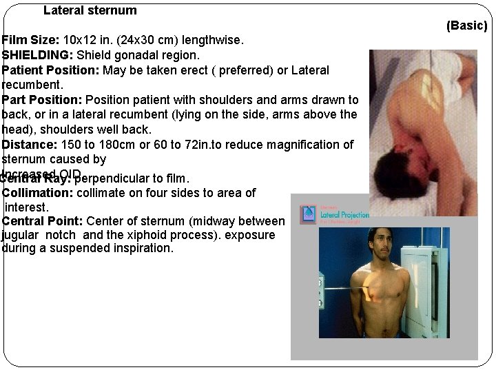 Lateral sternum Film Size: 10 x 12 in. (24 x 30 cm) lengthwise. SHIELDING: Lateral sternum Film Size: 10 x 12 in. (24 x 30 cm) lengthwise. SHIELDING: