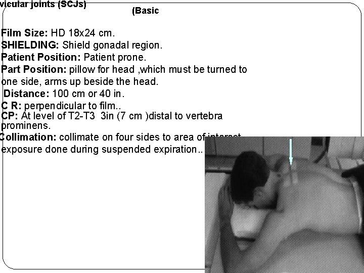 vicular joints (SCJs) (Basic Film Size: HD 18 x 24 cm. SHIELDING: Shield gonadal