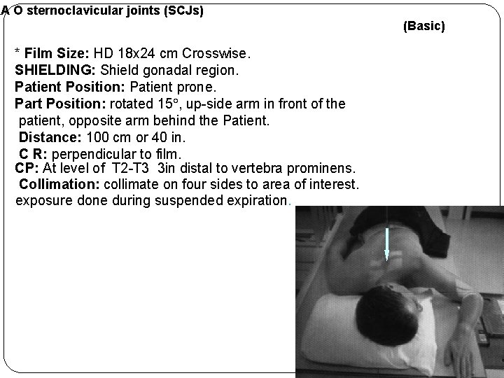 RA O sternoclavicular joints (SCJs) (Basic) * Film Size: HD 18 x 24 cm