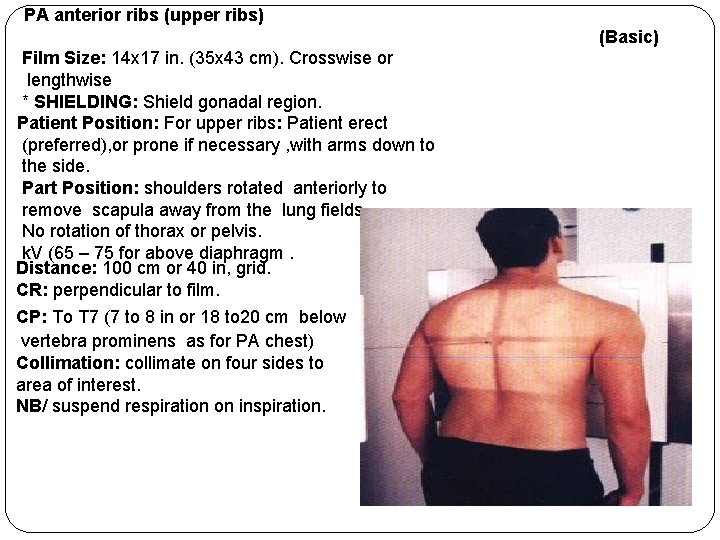 PA anterior ribs (upper ribs) (Basic) Film Size: 14 x 17 in. (35 x