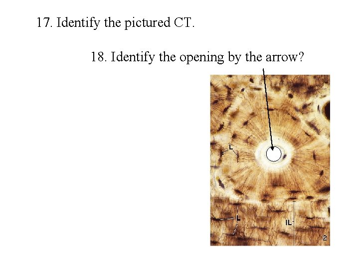 17. Identify the pictured CT. 18. Identify the opening by the arrow? 