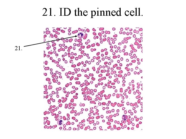 21. ID the pinned cell. 21. 