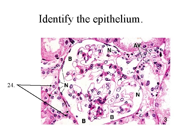 Identify the epithelium. 24. 