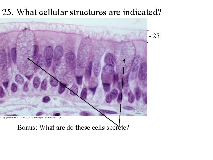 25. What cellular structures are indicated? 25. Bonus: What are do these cells secrete?