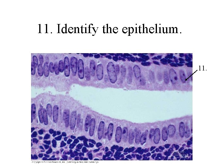 11. Identify the epithelium. 11. 