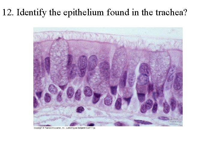 12. Identify the epithelium found in the trachea? 