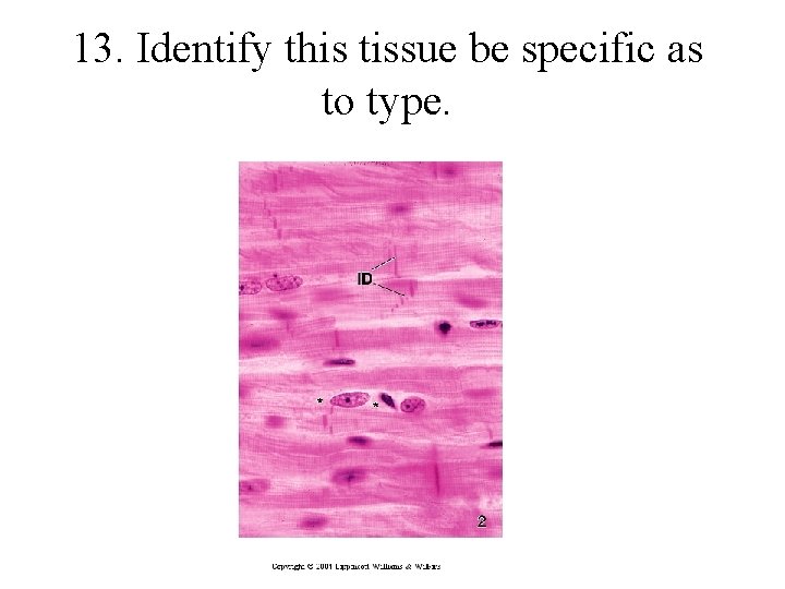 13. Identify this tissue be specific as to type. 