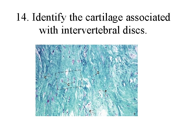 14. Identify the cartilage associated with intervertebral discs. 