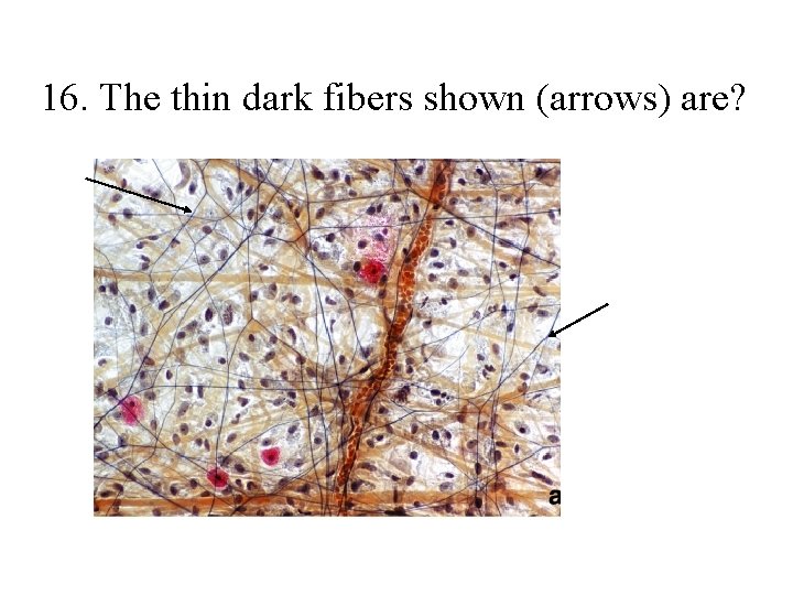 16. The thin dark fibers shown (arrows) are? 