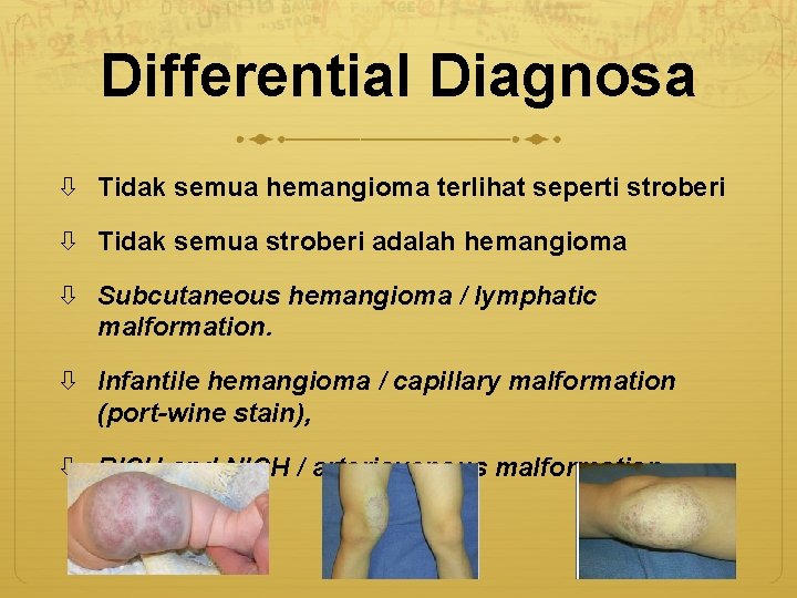 Differential Diagnosa Tidak semua hemangioma terlihat seperti stroberi Tidak semua stroberi adalah hemangioma Subcutaneous