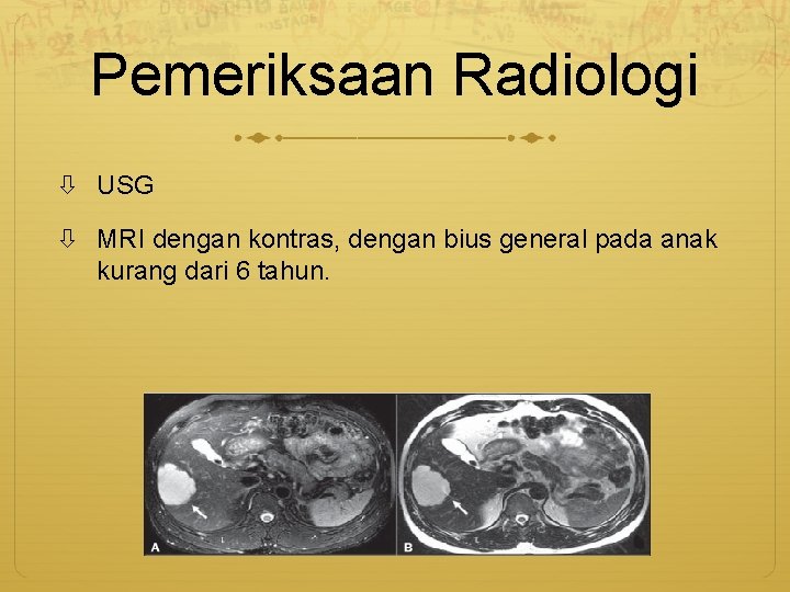 Pemeriksaan Radiologi USG MRI dengan kontras, dengan bius general pada anak kurang dari 6