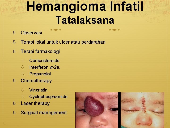 Hemangioma Infatil Tatalaksana Observasi Terapi lokal untuk ulcer atau perdarahan Terapi farmakologi Corticosteroids Interferon