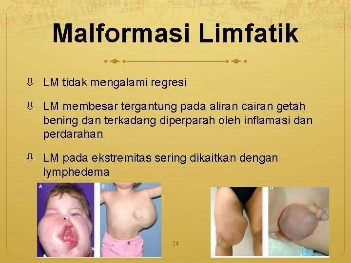 Malformasi Limfatik LM tidak mengalami regresi LM membesar tergantung pada aliran cairan getah bening
