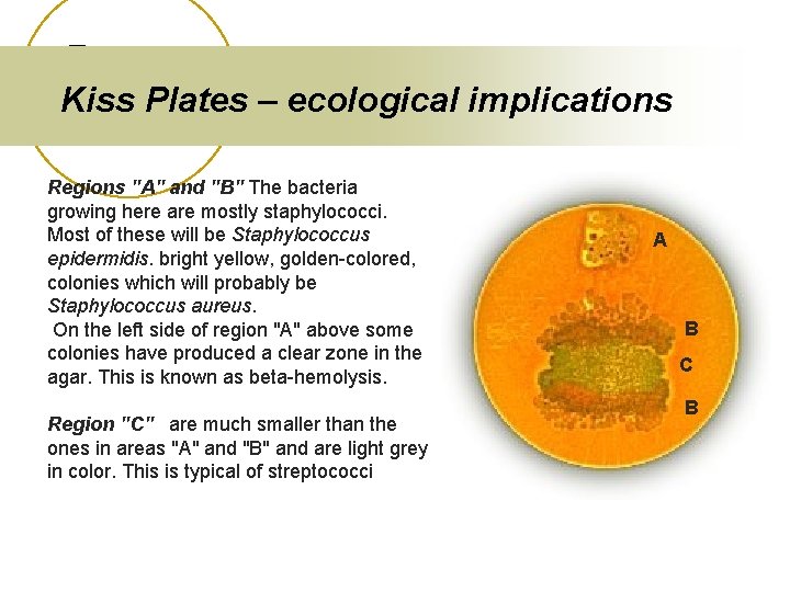 Kiss Plates – ecological implications Regions "A" and "B" The bacteria growing here are