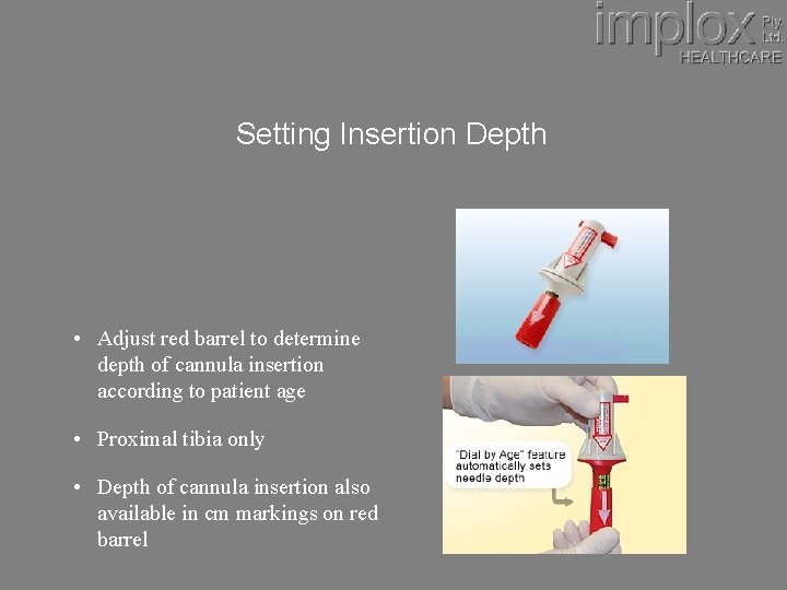 Setting Insertion Depth • Adjust red barrel to determine depth of cannula insertion according