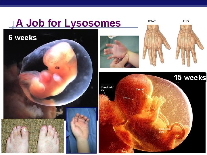 A Job for Lysosomes 6 weeks 15 weeks Regents Biology 