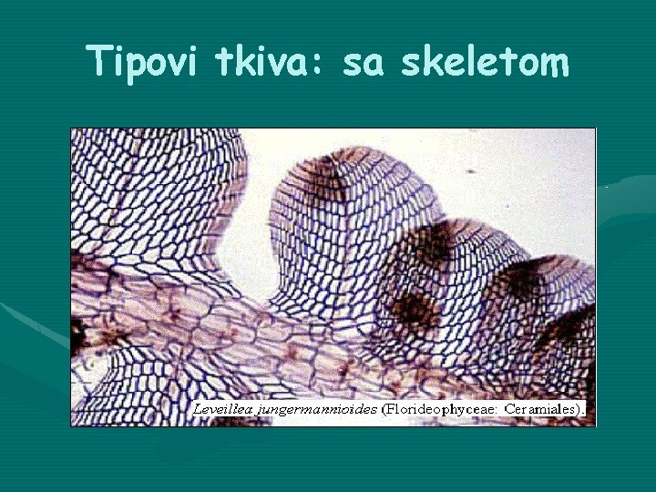 Tipovi tkiva: sa skeletom 