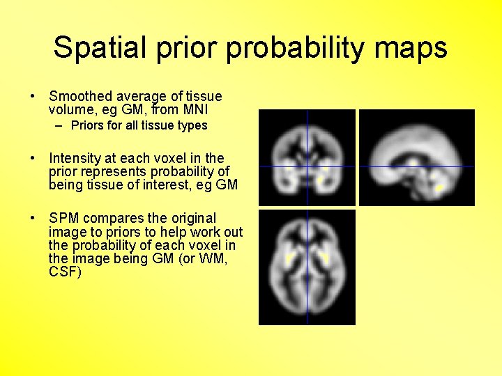 Spatial prior probability maps • Smoothed average of tissue volume, eg GM, from MNI