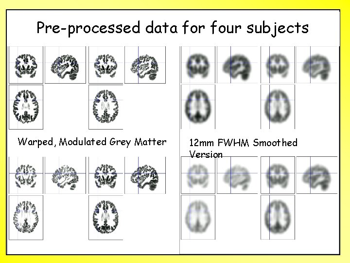 Pre-processed data for four subjects Warped, Modulated Grey Matter 12 mm FWHM Smoothed Version