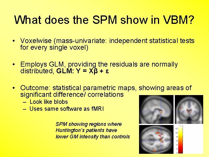 What does the SPM show in VBM? • Voxelwise (mass-univariate: independent statistical tests for