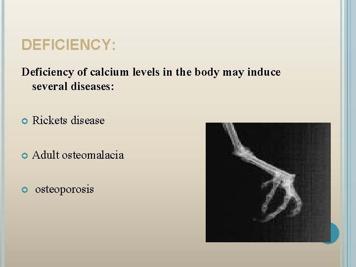 DEFICIENCY: Deficiency of calcium levels in the body may induce several diseases: Rickets disease