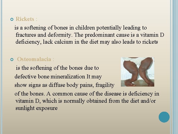 Rickets : is a softening of bones in children potentially leading to fractures and