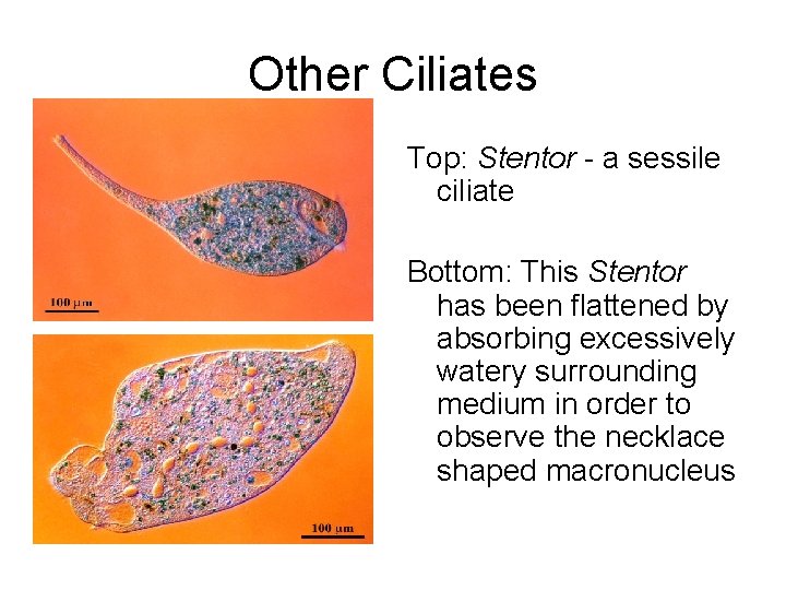 Other Ciliates Top: Stentor - a sessile ciliate Bottom: This Stentor has been flattened
