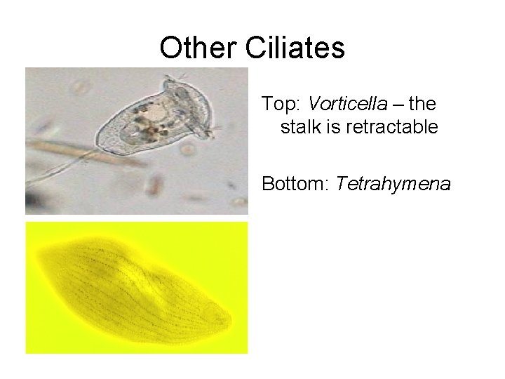Other Ciliates Top: Vorticella – the stalk is retractable Bottom: Tetrahymena 
