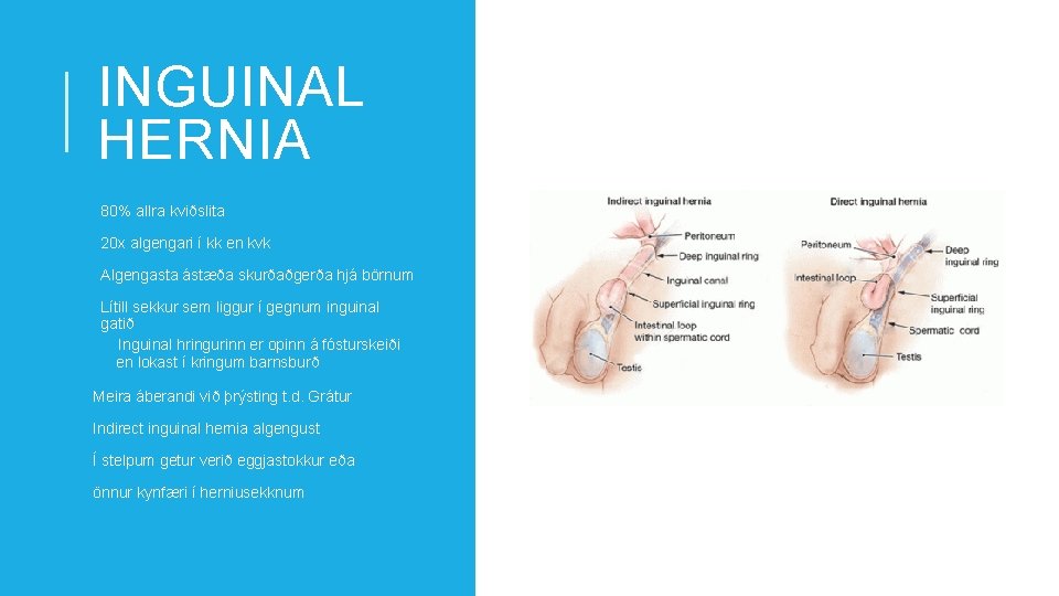 INGUINAL HERNIA 80% allra kviðslita 20 x algengari í kk en kvk Algengasta ástæða