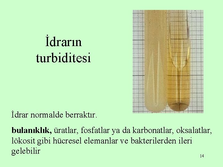 İdrarın turbiditesi İdrar normalde berraktır. bulanıklık, üratlar, fosfatlar ya da karbonatlar, oksalatlar, lökosit gibi