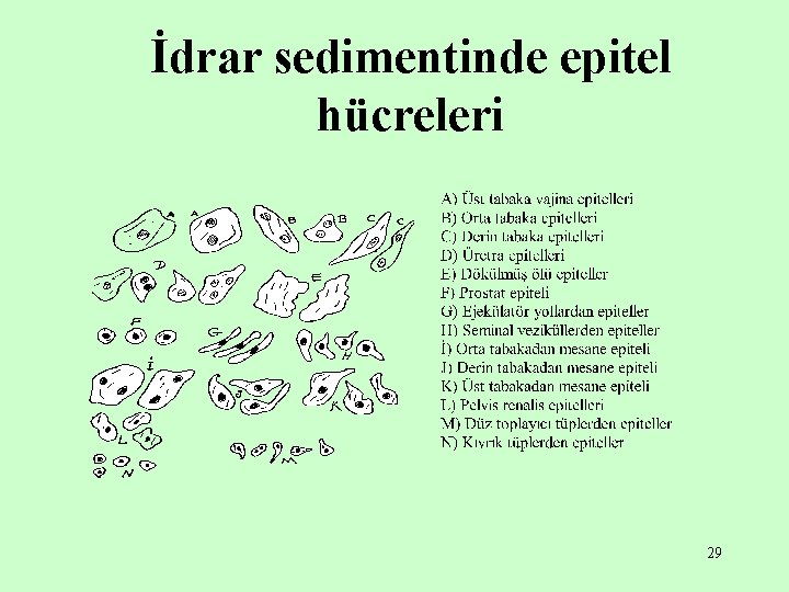 İdrar sedimentinde epitel hücreleri 29 