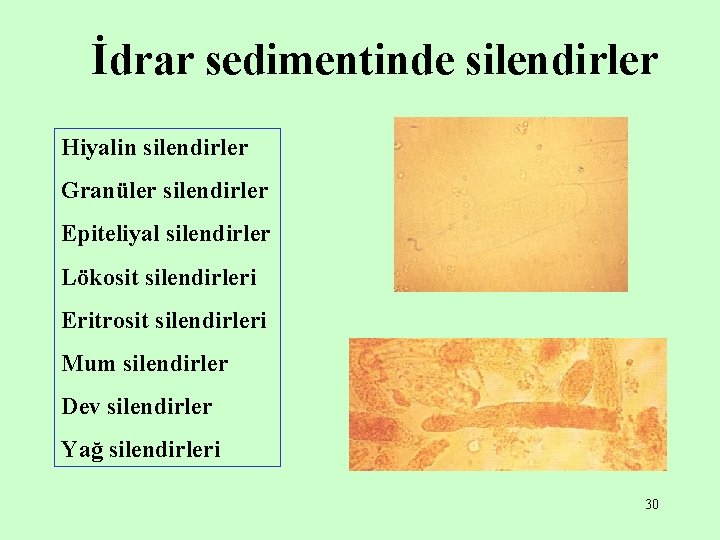 İdrar sedimentinde silendirler Hiyalin silendirler Granüler silendirler Epiteliyal silendirler Lökosit silendirleri Eritrosit silendirleri Mum