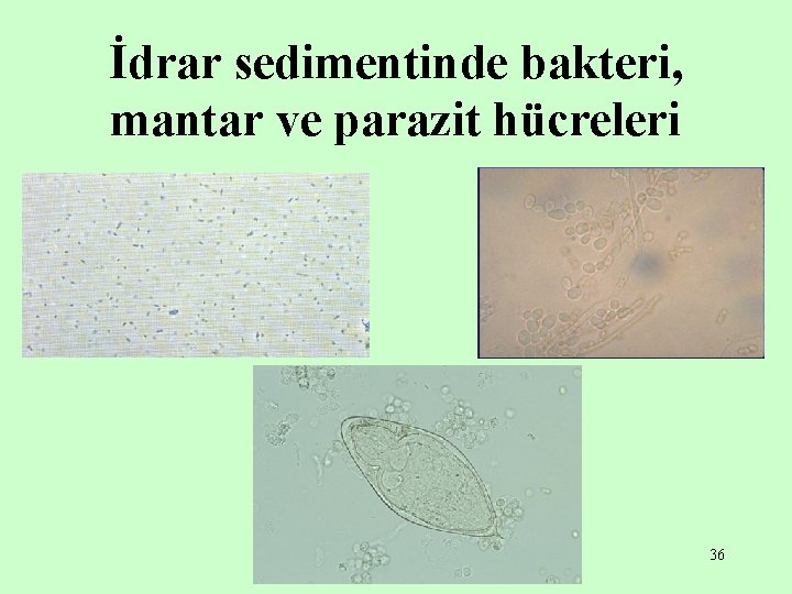 İdrar sedimentinde bakteri, mantar ve parazit hücreleri 36 