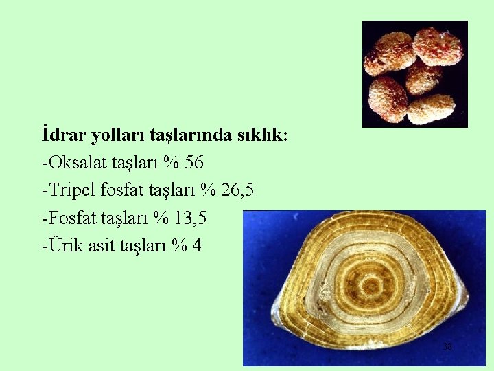 İdrar yolları taşlarında sıklık: -Oksalat taşları % 56 -Tripel fosfat taşları % 26, 5